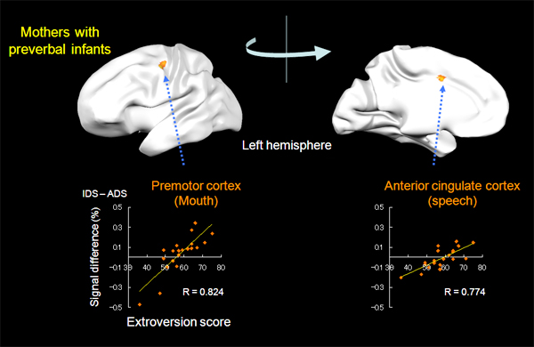 correlation of brain activity and level of extroversion