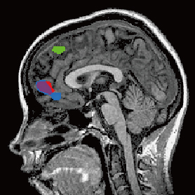 fMRI imaging of brain activity when simulating others