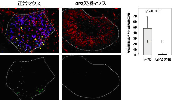 GP2ノックアウトマウスにおける大腸菌取り込み障害の図