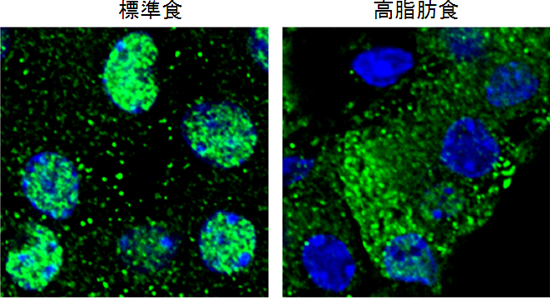 膵臓β細胞内の転写因子FOXA2の局在 （緑：FOXA2、青：核）の図
