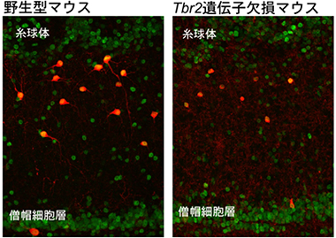 野生型マウスとTbr2遺伝子欠損マウスの介在ニューロンの分化の図