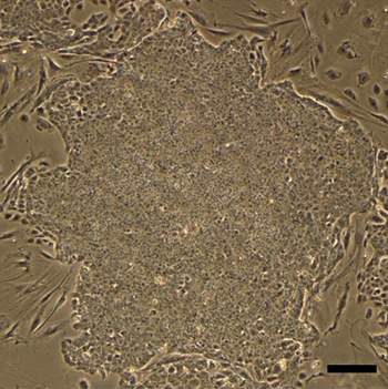 成体ウサギの胃の細胞から樹立したiPS細胞のコロニーの図