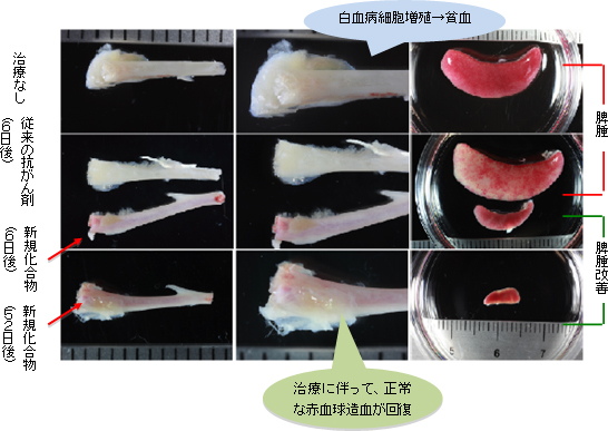 化合物投与による骨髄での白血病細胞減少・正常造血回復・脾腫消失の図