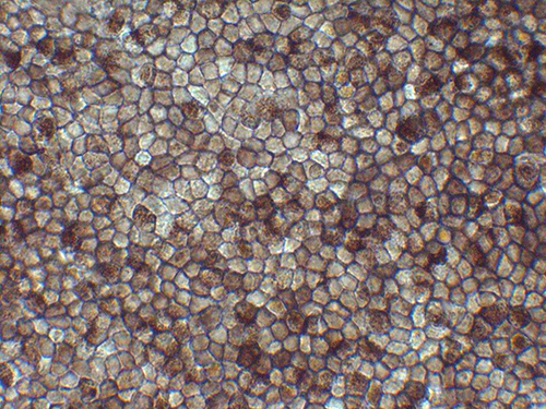 Photo of Retinal Pigment Epithelium (RPE) cells derived from human iPS cells