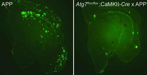 Photos showing that plaque formation depends on autophagy