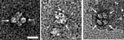 Hfqとカタラーゼ複合体の電子顕微鏡像の図