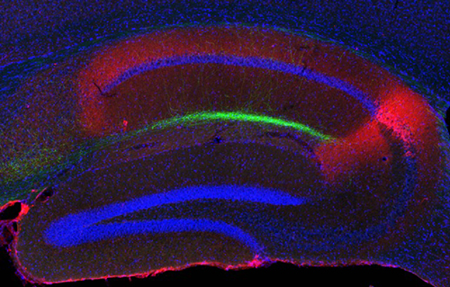 fluorescence imaging: island cell projection to the hippocampus c1