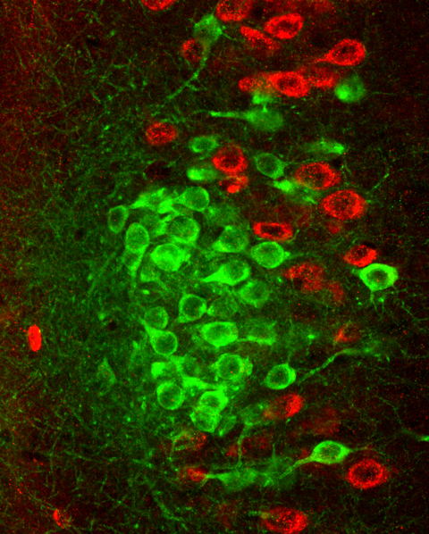 fluorescence imaging: clusters of island cells in the entorhinal cortex