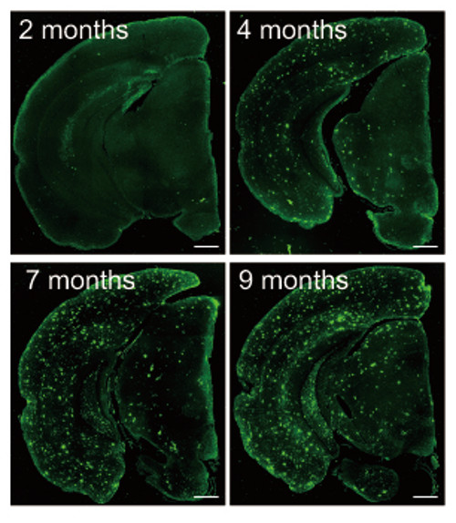 fluorescence imaging of ABeta accumulation is a second model mouse