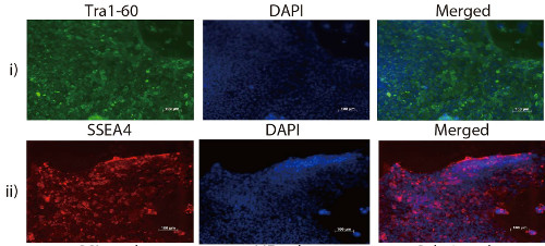 Fluorescence imaging:  immunostained human iPSCs