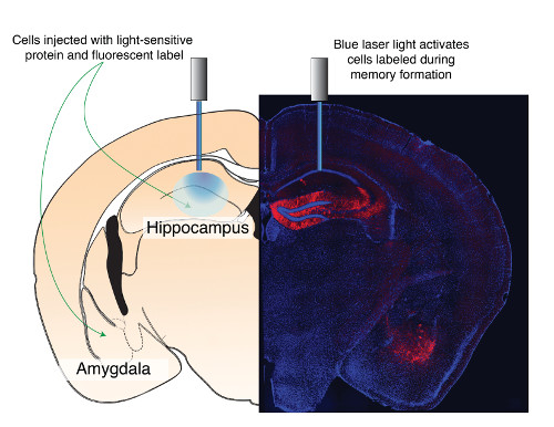 cartoon and image of the hippocampus and amygdala