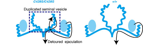 schematic depicting abnormal development of seminal vesicles