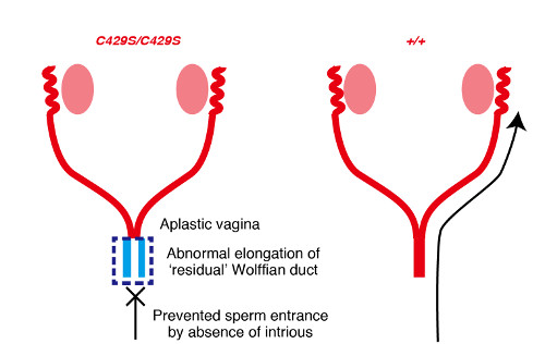 schematic depicting abnormal development of the vagina