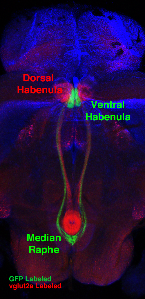 fluorescence labeling of the habenula-raphe pathway