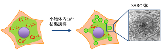 小胞体内カルシウム枯渇誘導とSARC体形成の図