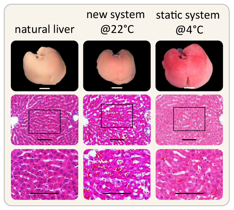 Images comparing Natural and Preserved Livers