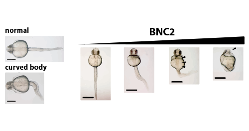 Pictures showing the effect of BNC2 on zebrafish development