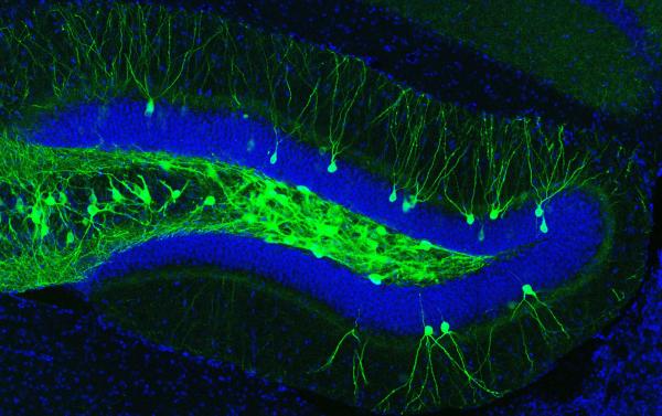 fluorescence imaging - engram cell in the dentate gyrus