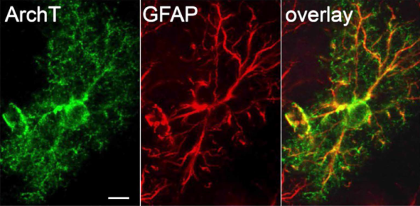 fluorescence labeling of astrocytes