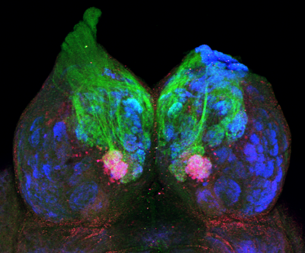 imaging showing where pheromonal PGF2a information enters the brain
