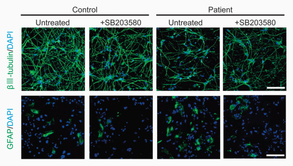fluorescence imaging - effects of p38 protein on neurogenic competence