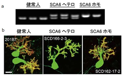 iPS細胞から分化誘導したプルキンエ細胞の図