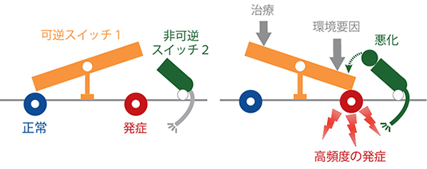 アトピー性皮膚炎の発症と悪化に関する「二重スイッチ数理モデル」の概要図