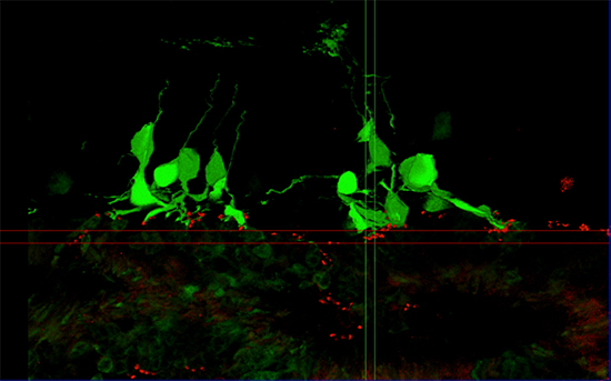 マウスiPS細胞から分化させた網膜組織を移植した網膜変性末期マウスの網膜の図