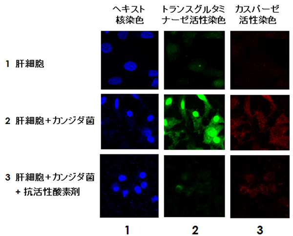 カンジダ菌との共培養による肝細胞中のトランスグルタミナーゼ（TG2）核局在の図