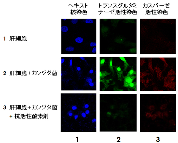 カンジダ菌との共培養による肝細胞中のトランスグルタミナーゼ(TG2)核局在の図