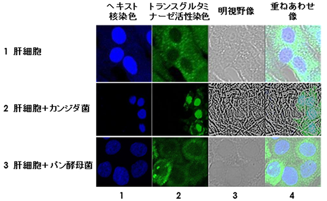 パン酵母との共培養による肝細胞中のトランスグルタミナーゼ（TG2）の図