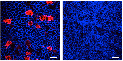 TRAF6欠損マウスにおけるM細胞の欠失の図