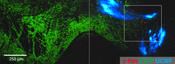 image of fluorescent labeling of VTA neurons and nanoparticles