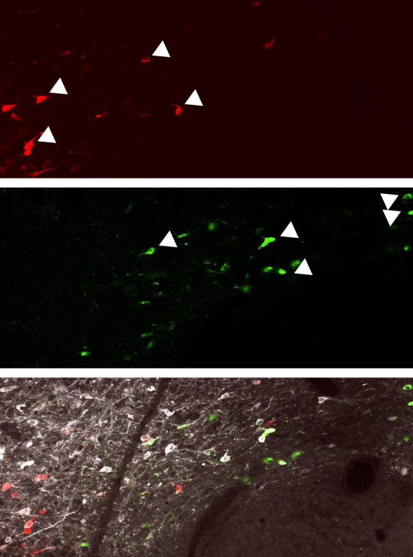 images of VTA-dopamine neurons
