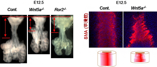 Wnt5aおよびRor2遺伝子変異マウスの気管形態異常の図