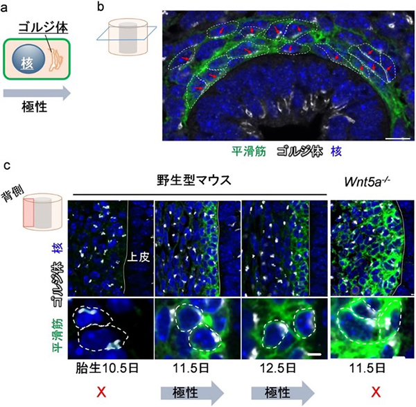 平滑筋細胞の放射状細胞極性とWnt5a遺伝子変異マウスにおける極性異常の図