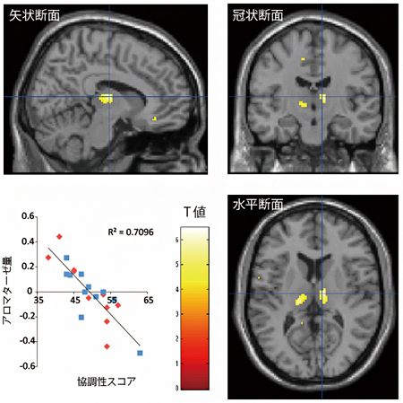 男女ともに視床（黄の部分）での脳内アロマターゼ量が高い人は、協調性スコアが低いの図