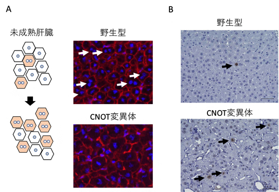 CNOT変異体マウスの肝臓で見られる未成熟肝臓の特徴の図