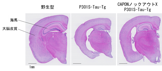 CAPONノックアウトX P301S-Tau-Tgマウスの脳の図