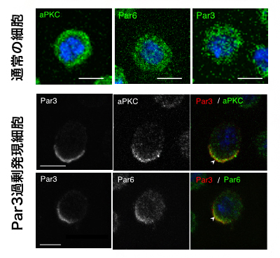 培養細胞において Par3の発現上昇により生じたタンパク質の非対称分布の図