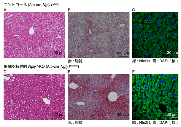 肝細胞特異的Ngly1-KOマウスの高フルクトース食事ストレスによる脂肪肝化の図