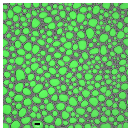 シルクタンパク質が形成する液液相分離の蛍光顕微鏡像の図