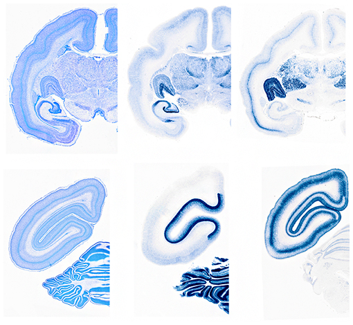 コモンマーモセット脳内でのさまざまな遺伝子発現の様子の図