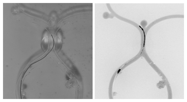 血管モデルの可視光による画像（左）と非被爆血管内治療シミュレータによるX線模擬画像の図
