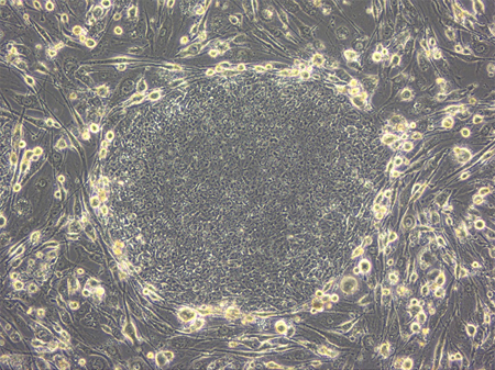 ヒトiPS細胞（201B7）の写真