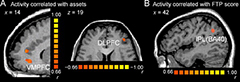 Image showing brain activity