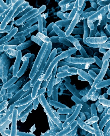Image of the bacteria