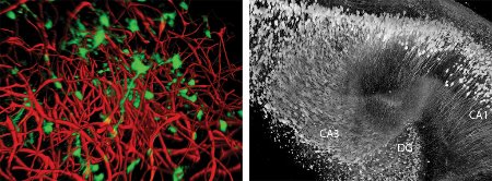 Image of neural stem cells and blood vessels
