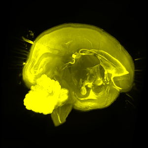 Image of a brain with CUBIC treament