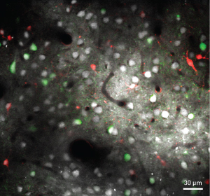 Image of cells in the visual cortex of a rat